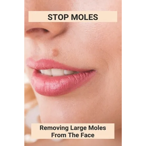 Stop Moles: Removing Large Moles From The Face: Surefire Way To Get Rid Of Moles - Paperback