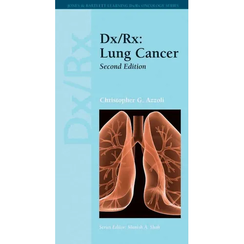 DX/Rx: Lung Cancer: Lung Cancer - Paperback