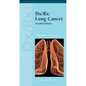 DX/Rx: Lung Cancer: Lung Cancer - Paperback