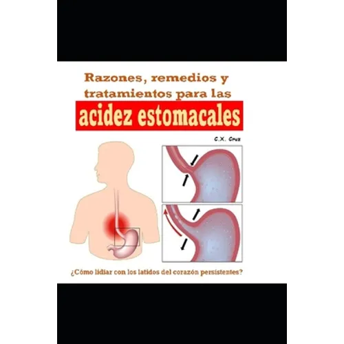 Razones, remedios y tratamientos para las acidez estomacales: ¿Cómo lidiar con los latidos del corazón persistentes? - Paperback