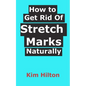 How to Get Rid Of Stretch Marks Naturally - Paperback