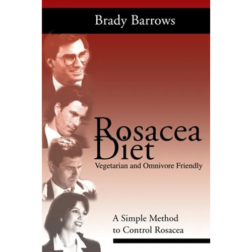 Rosacea Diet: A Simple Method to Control Rosacea - Paperback